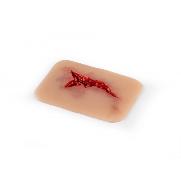 Wound Moulage "Laceration" – Προσομοίωση Ρήξης Δέρματος