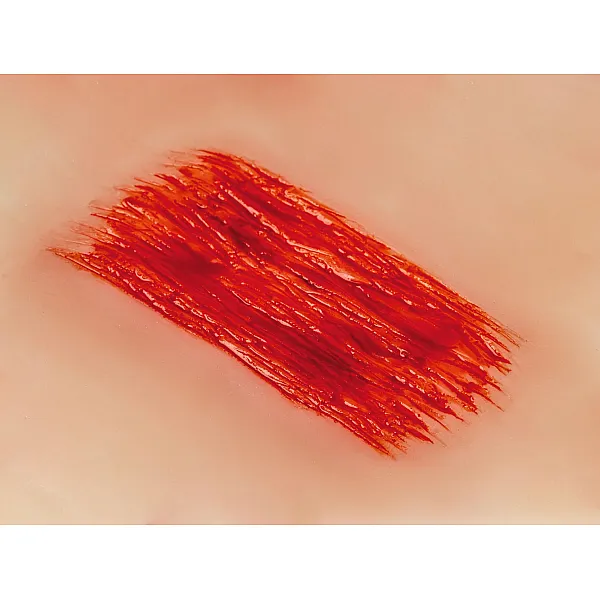 Wound Moulage "Abrasion" – Προσομοίωση Εκδοράς
