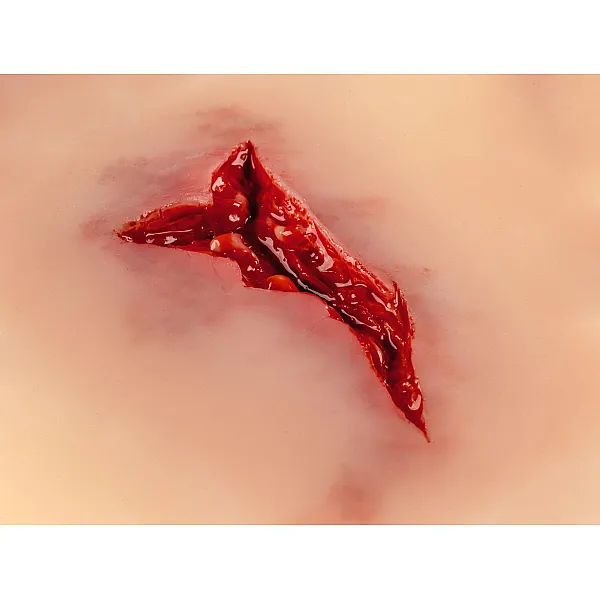 Wound Moulage "Laceration" – Προσομοίωση Ρήξης Δέρματος