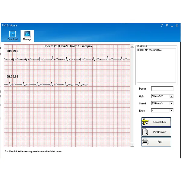 Καρδιογράφος τσέπης PM10 PALM ECG – με λογισμικό και Bluetooth